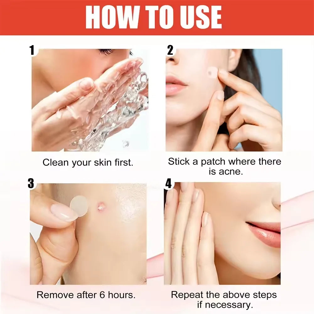 240pcs New Pimple Patch Acne Patches